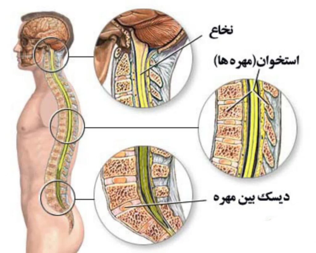 دلایل آسیب نخاعی