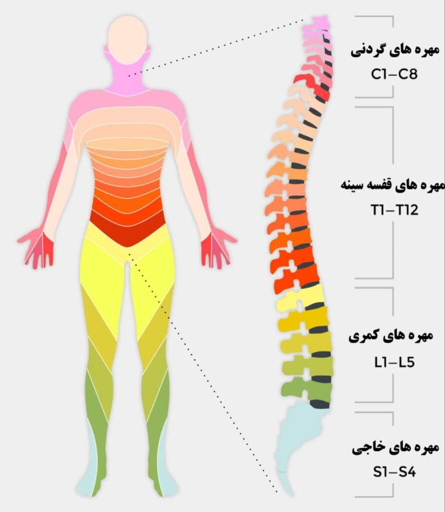 درمان قطع نخاع