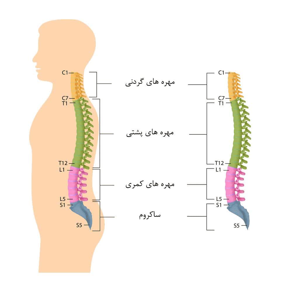 درمان قطع نخاع